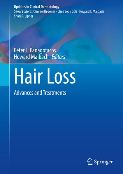 Hair Loss