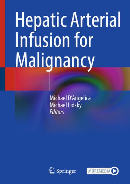 Hepatic Arterial Infusion for Malignancy