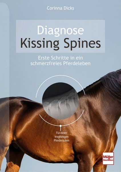 Diagnose Kissing Spines