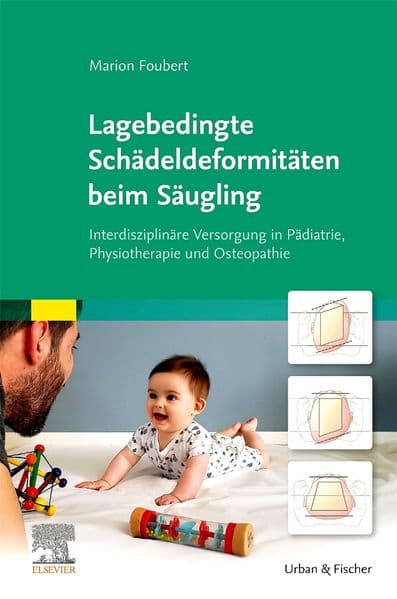 Lagebedingte Schädeldeformitäten beim Säugling