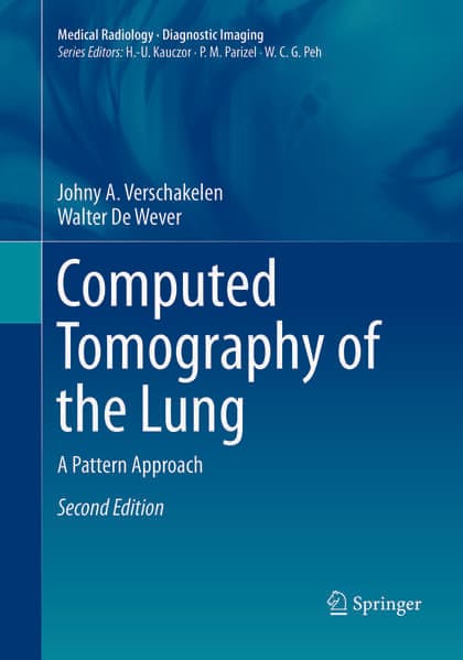 Computed Tomography of the Lung