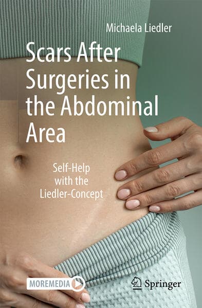 Scars After Surgeries in the Abdominal Area