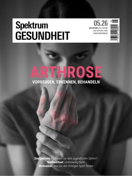 Spektrum Gesundheit 5/2026 - Arthrose