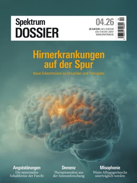 Spektrum Dossier 4/2026 Hirnerkrankungen auf der Spur