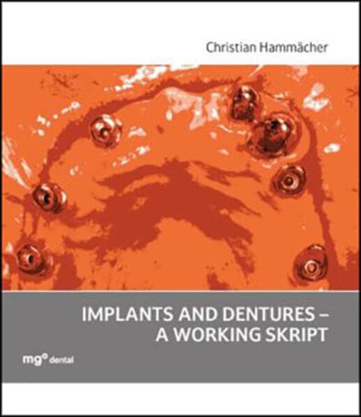 Implants and dentures - a working skript
