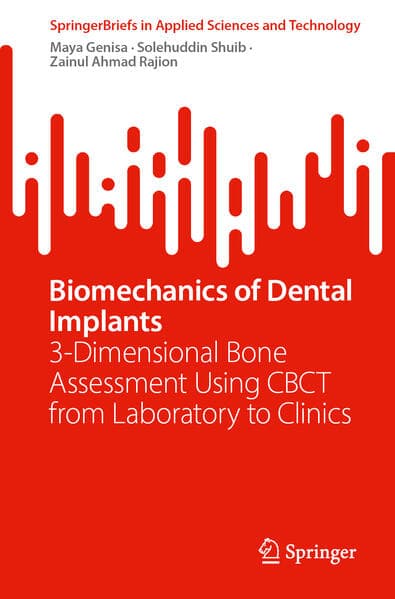 Biomechanics of Dental Implants