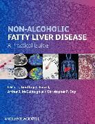 Non-Alcoholic Fatty Liver Disease