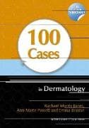 100 Cases in Dermatology