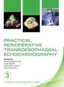 Practical Perioperative Transoesophageal Echocardiography