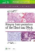 Biopsy Interpretation of the Head and Neck