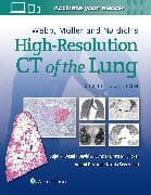 Webb, Müller and Naidich's High-Resolution CT of the Lung