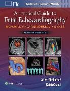 A Practical Guide to Fetal Echocardiography