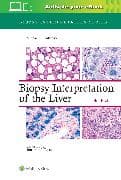 Biopsy Interpretation of the Liver