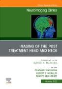 Imaging of the Post Treatment Head and Neck, An Issue of Neuroimaging Clinics of North America: Volume 32-1
