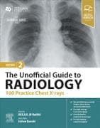 The Unofficial Guide to Radiology: 100 Practice Chest X-Rays