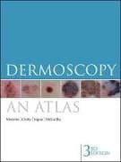 Dermoscopy