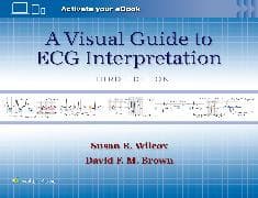 A Visual Guide to ECG Interpretation: Print + eBook with Multimedia