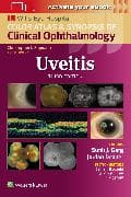 Uveitis