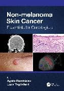 Non-melanoma Skin Cancer