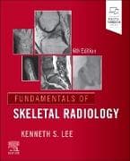 Fundamentals of Skeletal Radiology