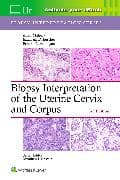 Biopsy Interpretation of the Uterine Cervix and Corpus: Print + eBook with Multimedia
