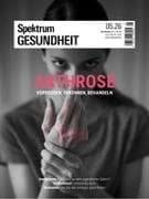 Spektrum Gesundheit 5/2026 - Arthrose
